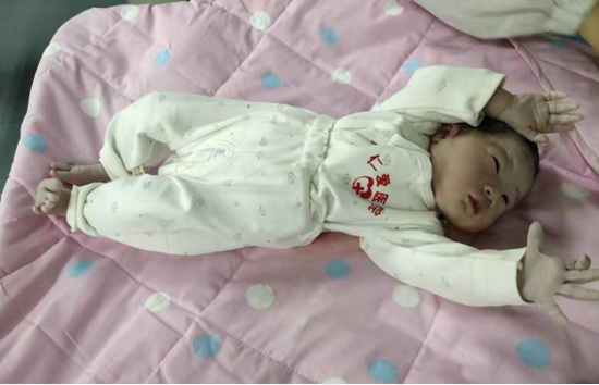 胎兒臍帶繞頸3周，醫(yī)生助力成功生產(chǎn)