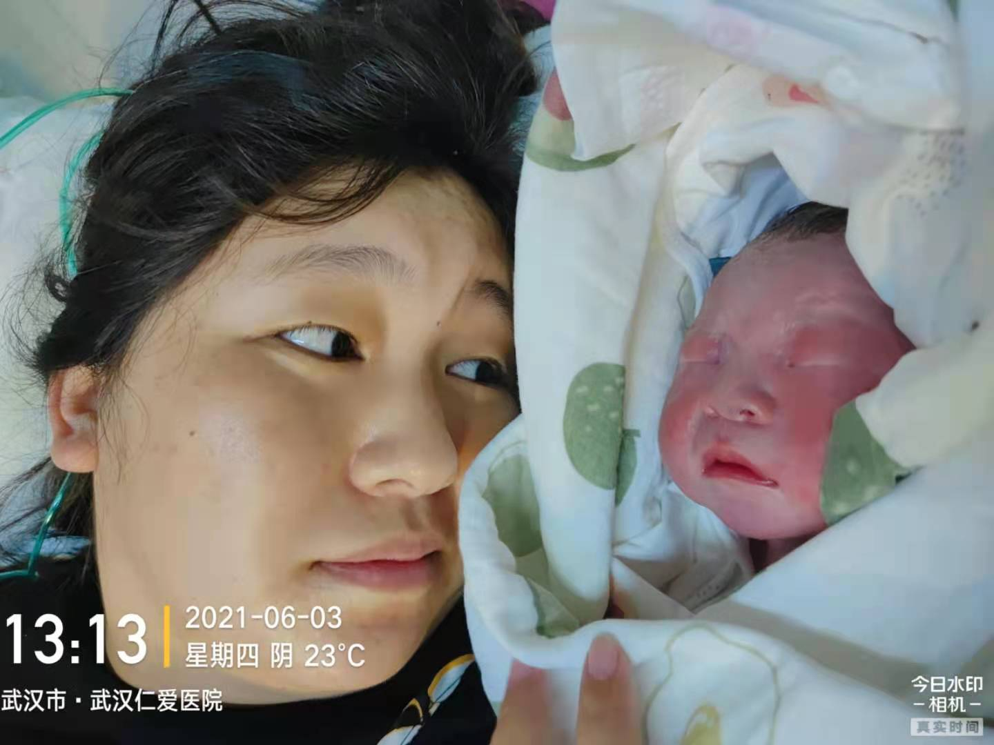 瘢痕子宮順產(chǎn)，圓媽媽順產(chǎn)夢